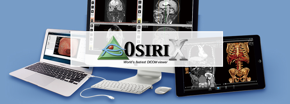 OsiriX イングメディカル株式会社